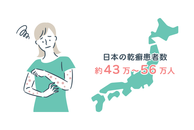 日本の乾癬患者数 約43万~56万人